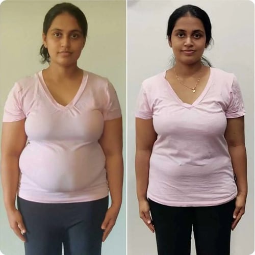 Fat freezing before and after — full body fat reduction at Vivo Body & Skin Clinic