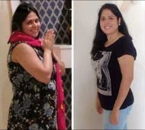 Fat freezing before and after — body contouring at Vivo Body & Skin Clinic